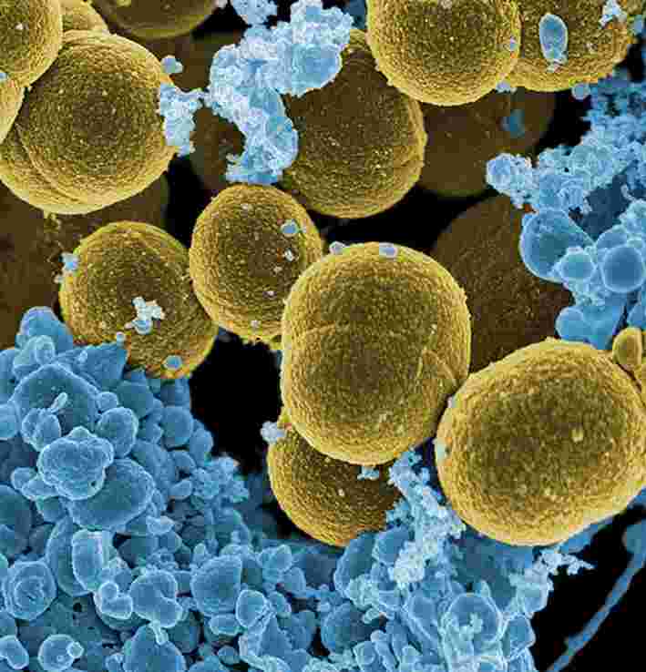 黃金葡萄球菌感染，可以可分解電子植入物來治療。
