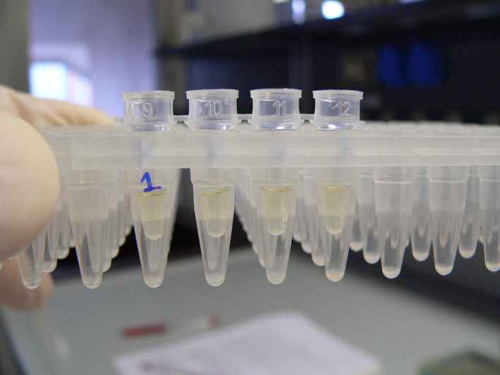 實驗室的細菌容液，微流體晶片能加速這種檢測嗎?