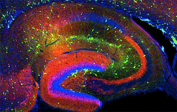 老鼠腦部的中間神經元(綠色)，建立訊息線路，連結感覺和運動神經元。
