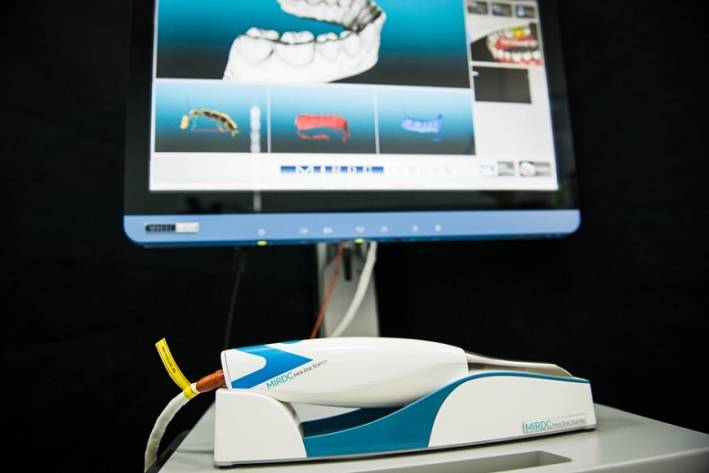 口內掃描系統與數位化牙體製造