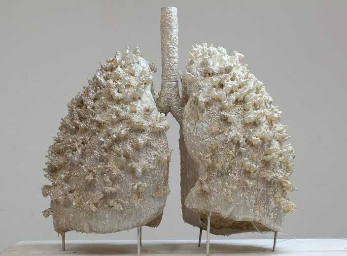 肺部模型，小氣體通道相當複雜，能在體外模以嗎? 