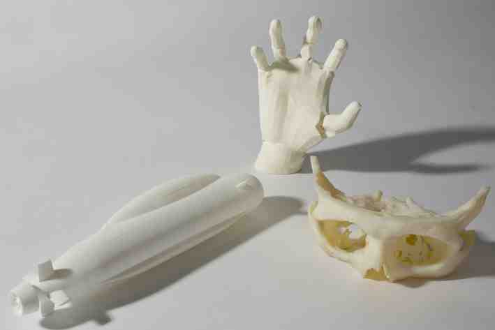 改造3D列印機列印軟骨?列印手術修補用氣管