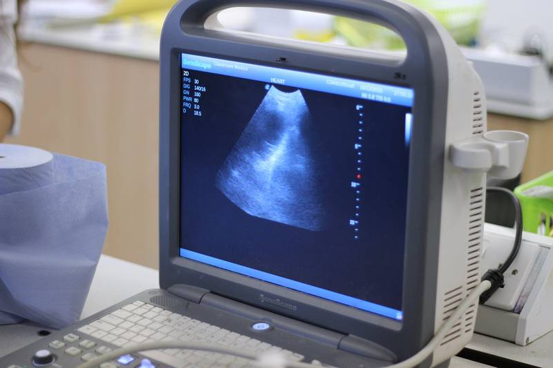 OLED應用於醫材?超音波醫學影像
