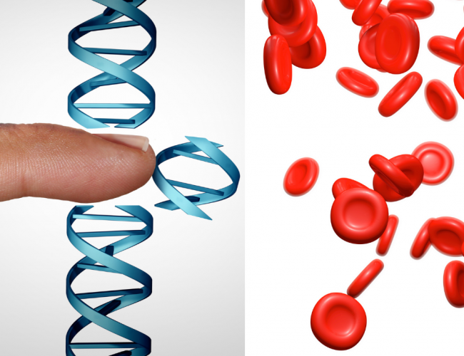 CRISPR技術的臨床實驗首獲美國FDA核准，治療鐮形血球貧血症
